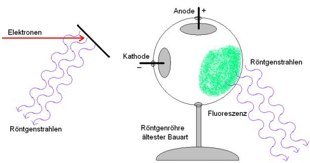 Röntgenstrahlen